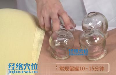 拔罐的方法：多罐法示范圖