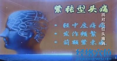 緊張型頭痛的特點(diǎn)