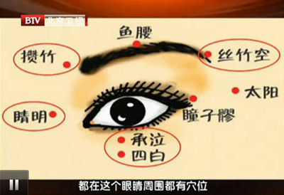 眼部穴位圖